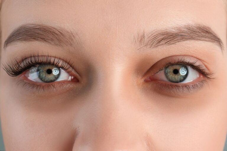 Cernes fatigue yeux