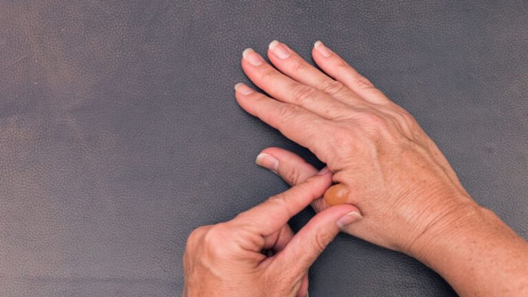 Pourquoi ne pas percer une cloque de brûlure ?